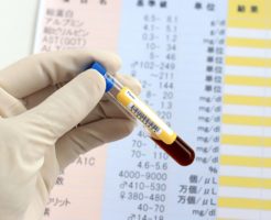 30秒に一本。足や指が切断されている病気