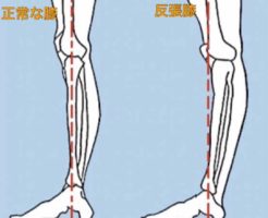 100歳まで歩ける。膝の荷重ポジション！