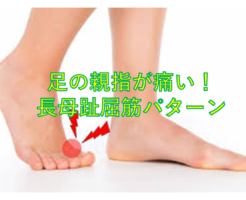 足の親指が痛い！長母趾屈筋パターン